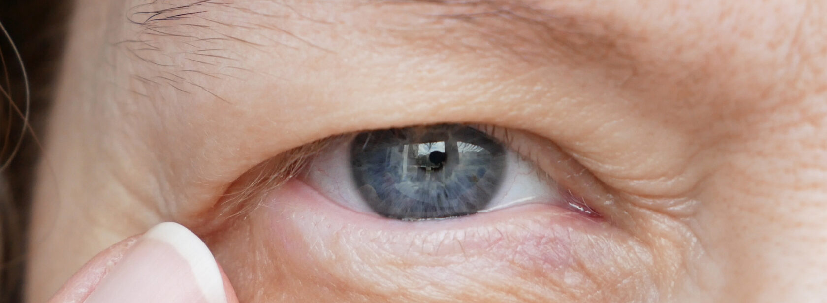 Weibliches Auge mit Schlupflid